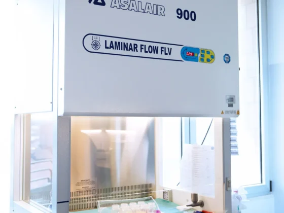 Cappa latte Materno Ospedale San Bortolo di Vicenza